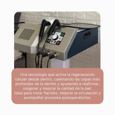 Radiofrecuencia facial y corporal